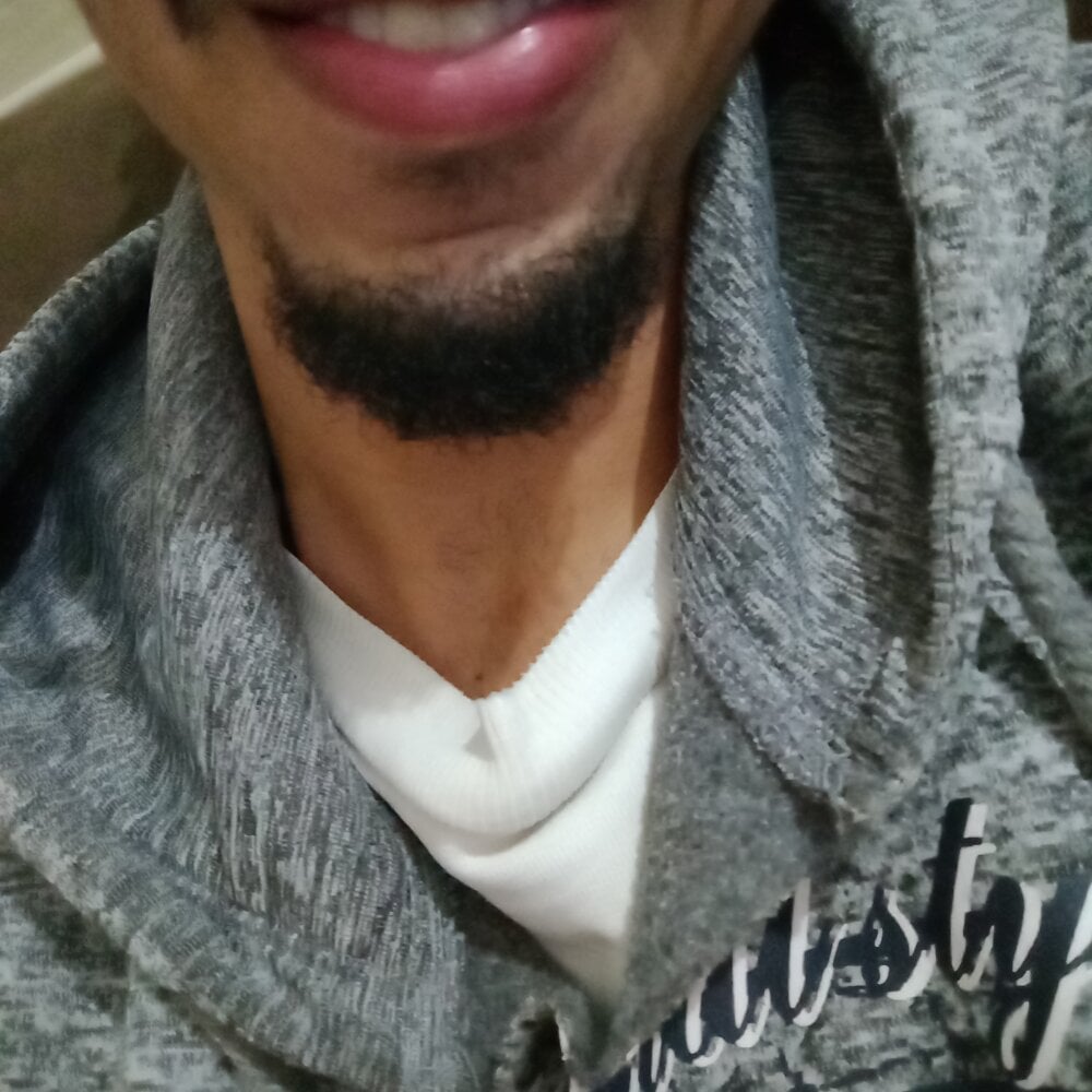 MagrinPentelho1