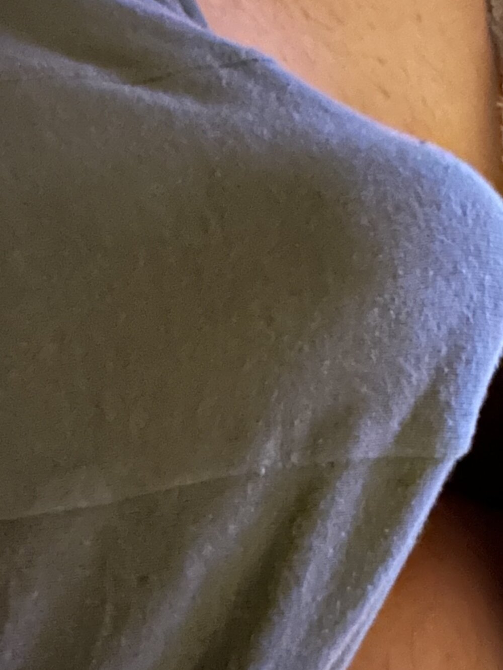 Max_2515