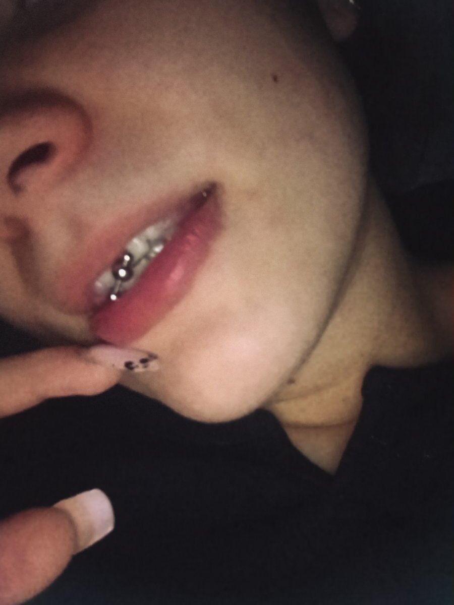 MeCherryy
