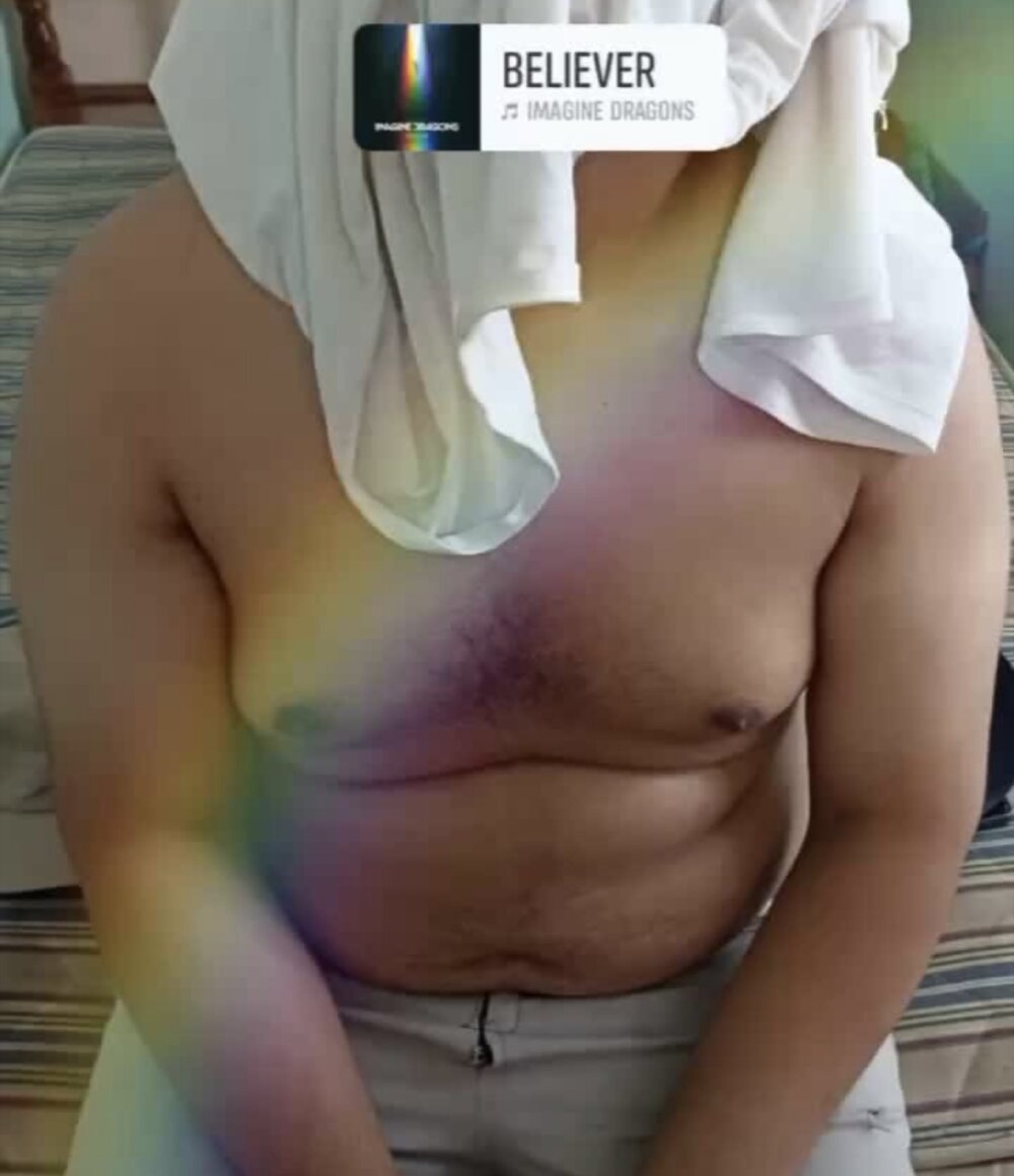 Ositomex1