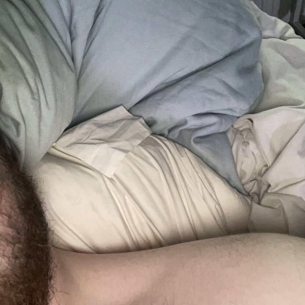 nl2811Anal