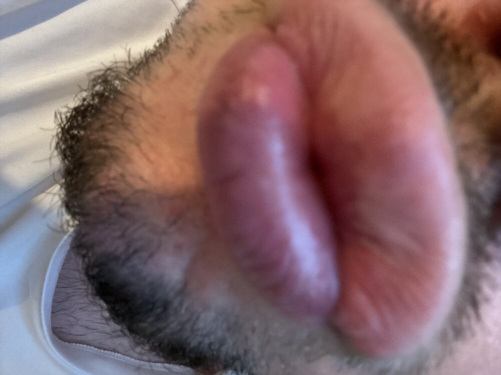 small_harry